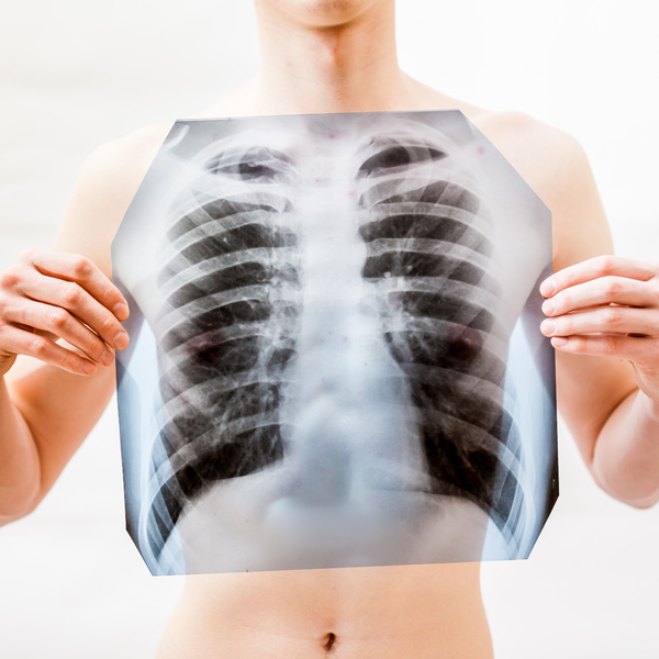 慢性肺阻塞肺病的致病因子